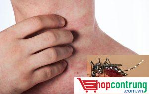 Bệnh sốt xuất huyết do con muỗi gây ra.