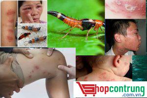 tác hại của kiến 3 khoang với người